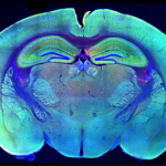 Imaging of the human brain: cerebral cortex, hippocampus & thalamus.